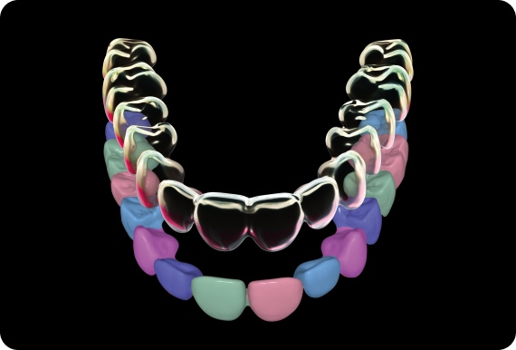 Lux Creo 4D Aligners